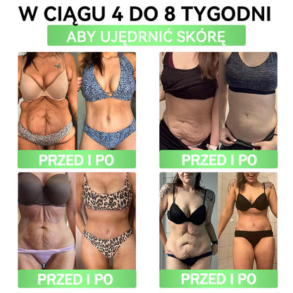 🍀🍀𝑨𝑵𝑮𝑬𝑳𝑻𝑹𝑨𝑷® Moringa × Berberyna × AMPK 10-w-1 Wsparcie metaboliczne, plaster z nanotechnologią mikroigłową 🇵🇱(Wystarczy raz dziennie, widoczne efekty w 7 dni) ✅ Na otyłość, wiotką skórę, cukrzycę, bezdech senny, problemy ze stawami i wiele innych