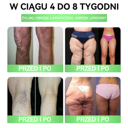 🍀🍀𝑨𝑵𝑮𝑬𝑳𝑻𝑹𝑨𝑷® Moringa × Berberyna × AMPK 10-w-1 Wsparcie metaboliczne, plaster z nanotechnologią mikroigłową 🇵🇱(Wystarczy raz dziennie, widoczne efekty w 7 dni) ✅ Na otyłość, wiotką skórę, cukrzycę, bezdech senny, problemy ze stawami i wiele innych