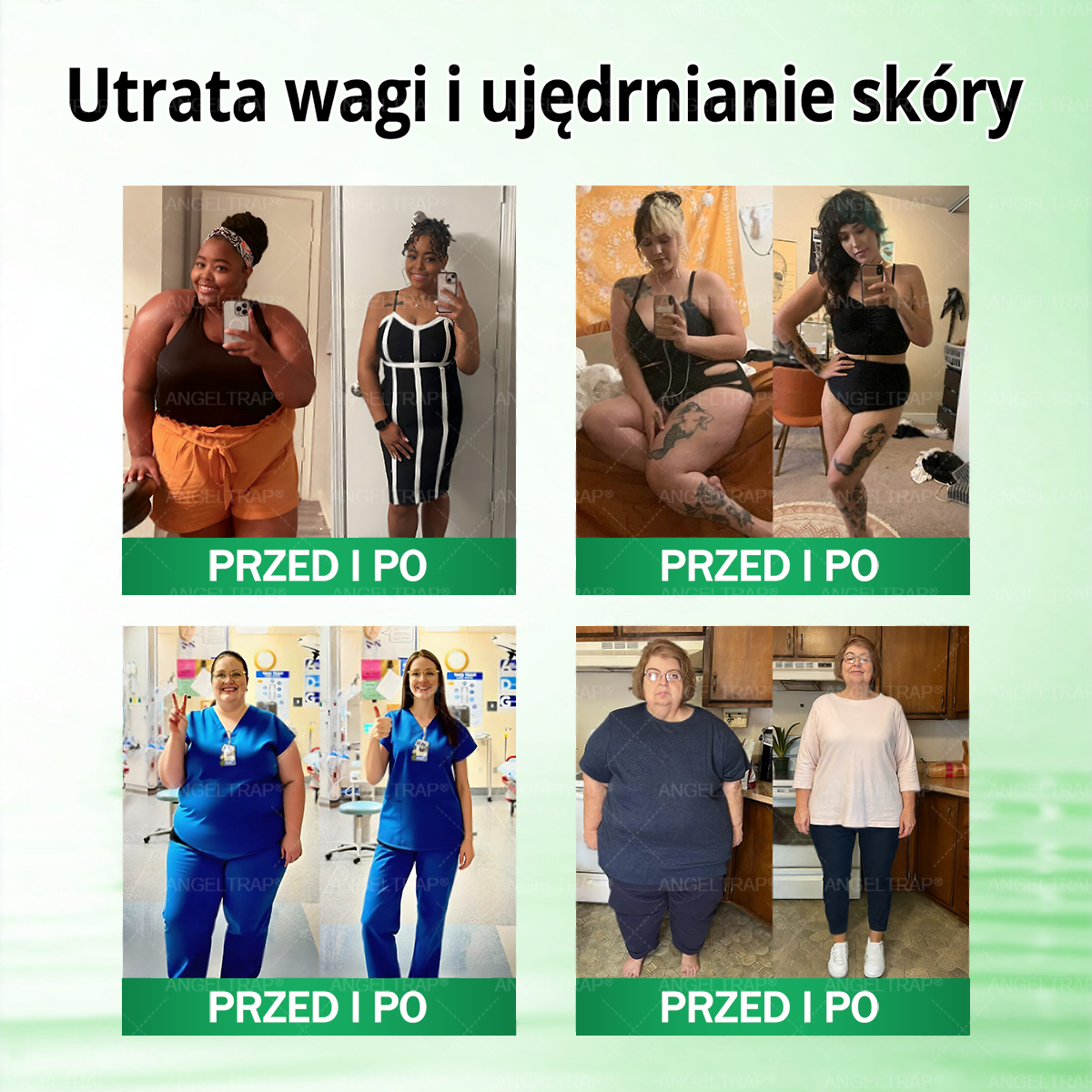 🍀🍀𝑨𝑵𝑮𝑬𝑳𝑻𝑹𝑨𝑷® Moringa × Berberyna × AMPK 10-w-1 Wsparcie metaboliczne, plaster z nanotechnologią mikroigłową 🇵🇱(Wystarczy raz dziennie, widoczne efekty w 7 dni) ✅ Na otyłość, wiotką skórę, cukrzycę, bezdech senny, problemy ze stawami i wiele innych