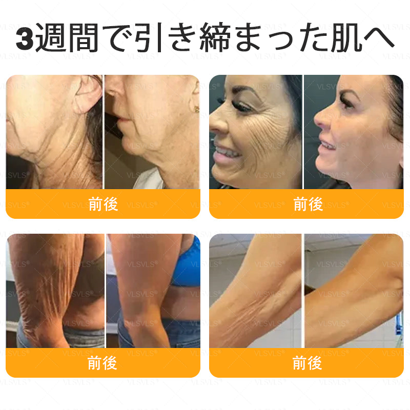 🇯🇵 日本製・日本から直送 🥇🥇  𝑽𝑳𝑺𝑽𝑳𝑺® ビーベノム コンプリヘンシブ クリーム  本日最終日｜80％OFF（肌のたるみ、乾燥による小ジワ、ハリ不足、バストラインやヒップラインの印象など、年齢とともに気になるボディスキンをトータルケア。うるおいとハリを与え、なめらかで引き締まった印象の肌へ導きます）
