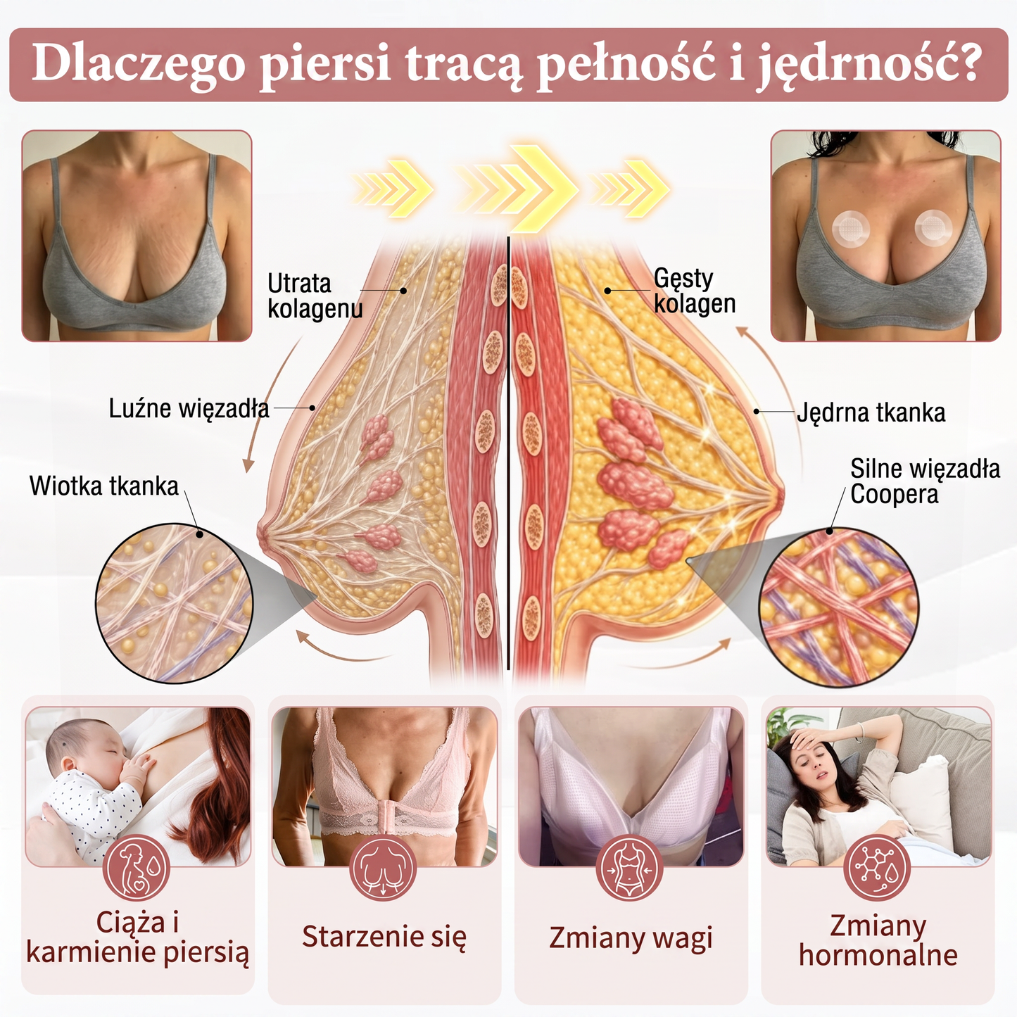 🌟 HISKIN® Mikroigłowe plastry na piersi wspierające efekt pełniejszego wyglądu, liftingu i ujędrnienia（副本）